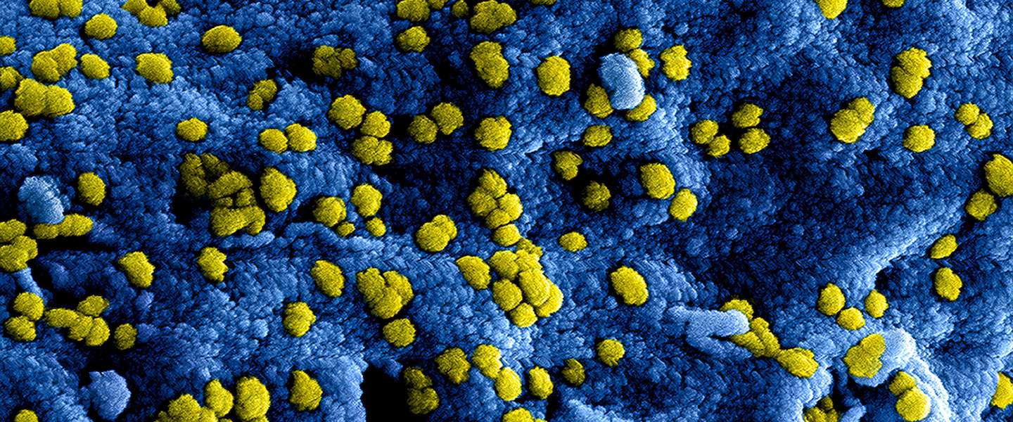 De aanpak van nepnieuws over het coronavirus door de grootste techbedrijven ter wereld