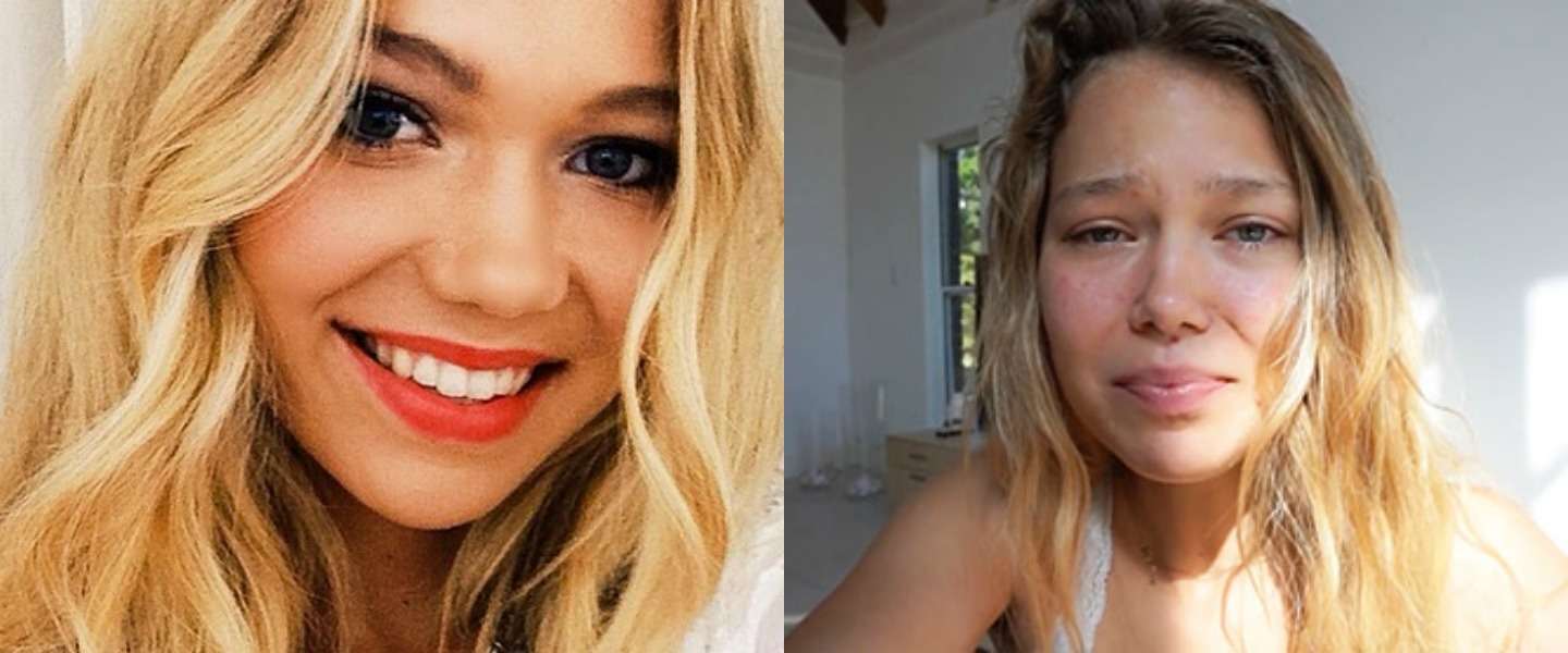 Instagram-model Essena O'Neill: was het allemaal een stunt?