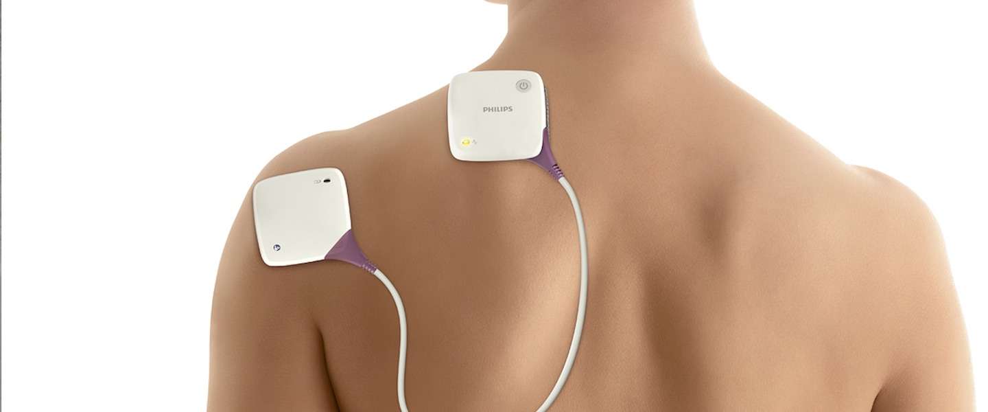 Innovaties op gebied van chronische pijnklachten