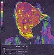 1150979046Stralingsbeeld