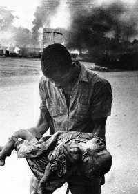 1183940248BNW-Carlisle-Umunna-Nigeria-Biafra-War-child-casualty-3