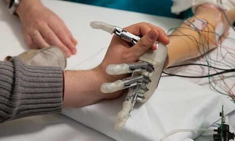 Bionische hand met "tast"-ervaring