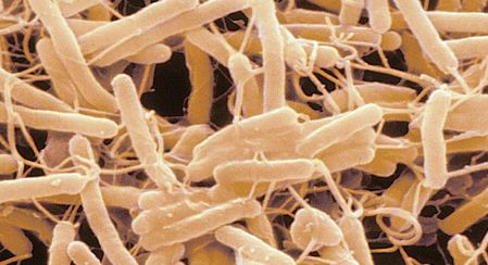 De smartphone van artsen blijkt een bacteriebron te zijn