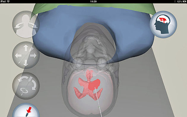 Gratis iPad-app helpt neurochirurgen met trainen