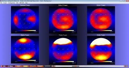 Sony EEG Scalp Maps