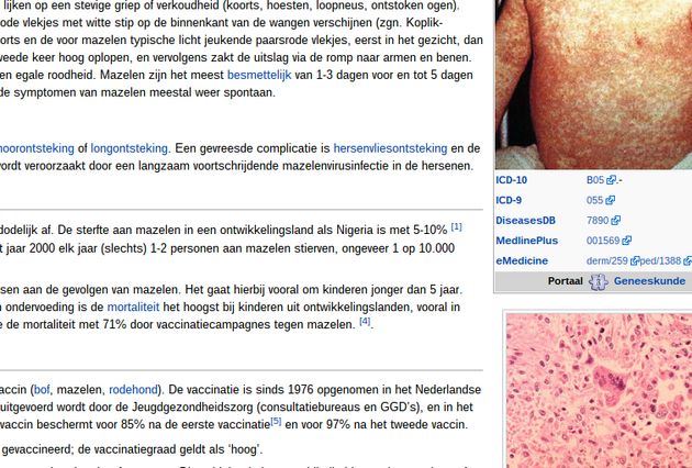 Studiepunten voor het verbeteren van pagina's in Wikipedia