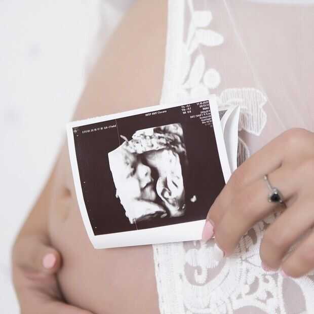 AI-echo maakt levensechte beelden van je ongeboren baby