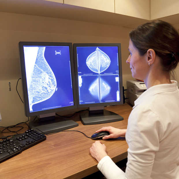 AI van Google helpt borstkanker nog nauwkeuriger te herkennen