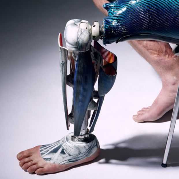 Mooi: design-protheses die de aandacht vragen