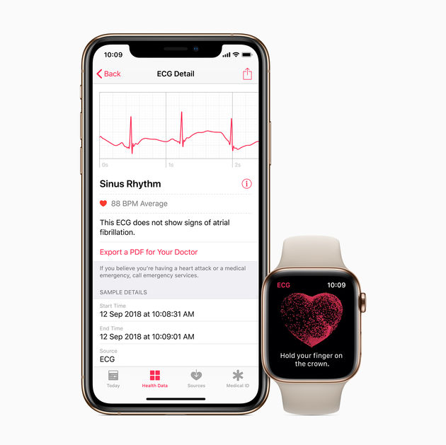 ECG-app_iPhone-Watch-