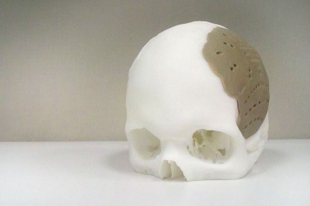 Gezichtsreconstructie met 3D printen